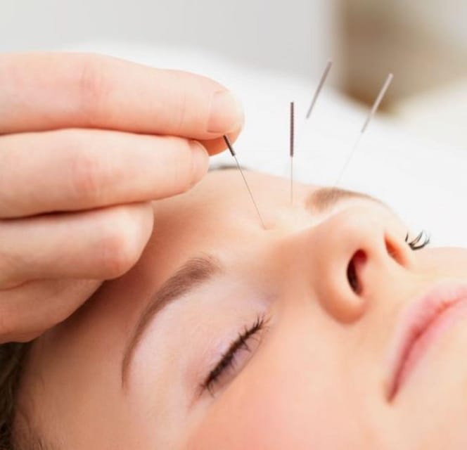 Acupuncture for Relaxation and Wellness - Key Points