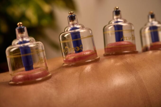 Cupping Therapy - Additional Information