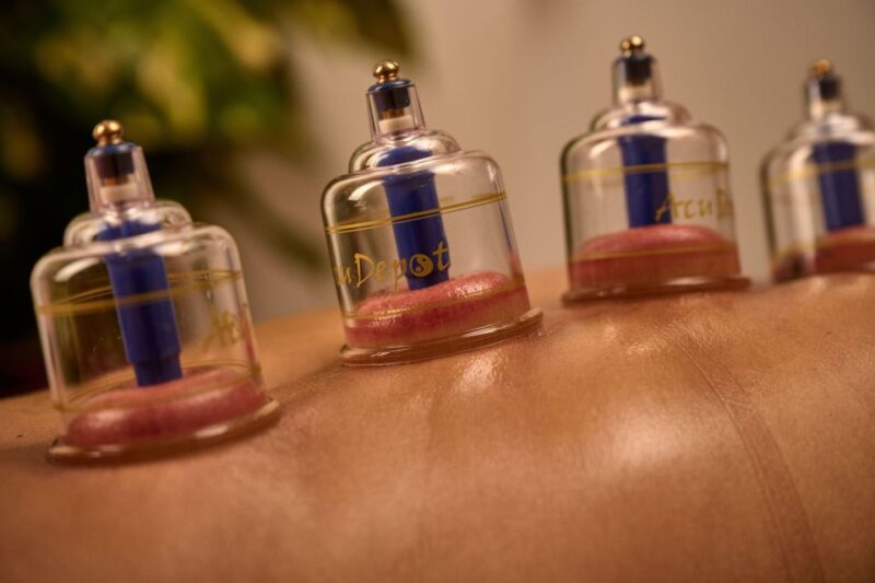 Cupping Therapy - Cupping Therapy Techniques
