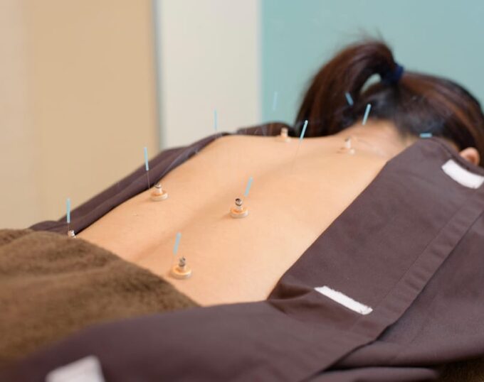 Hiroshima: Acupuncture and Japanese Unique Massage Treatment - Flexible Scheduling