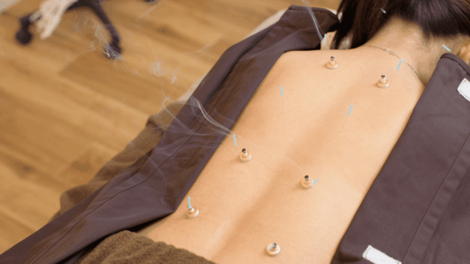 Hiroshima: Acupuncture and Japanese Unique Massage Treatment - Frequently Asked Questions